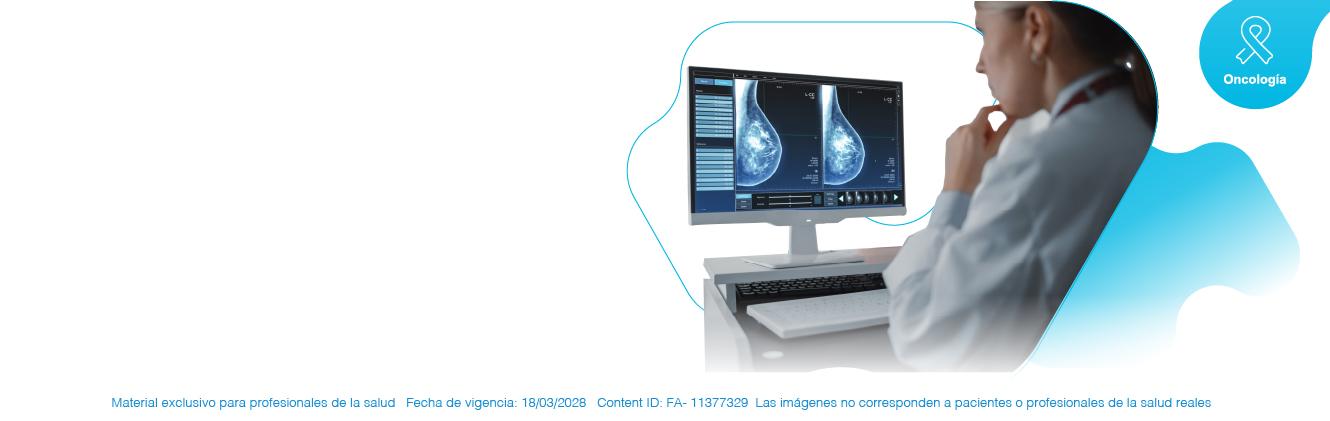 Cáncer de mama: Información médica con MedForum