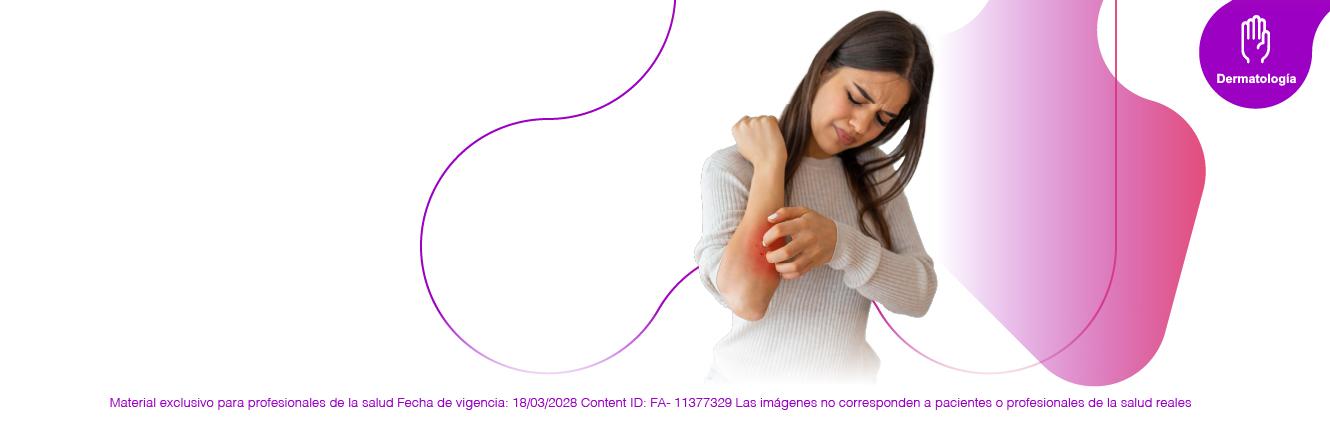 Conoce qué es la Psoriasis: Tipos, causas, tratamientos y más con MedForum