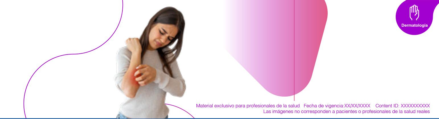 Conoce qué es la Psoriasis: Tipos, causas, tratamientos y más con MedForum