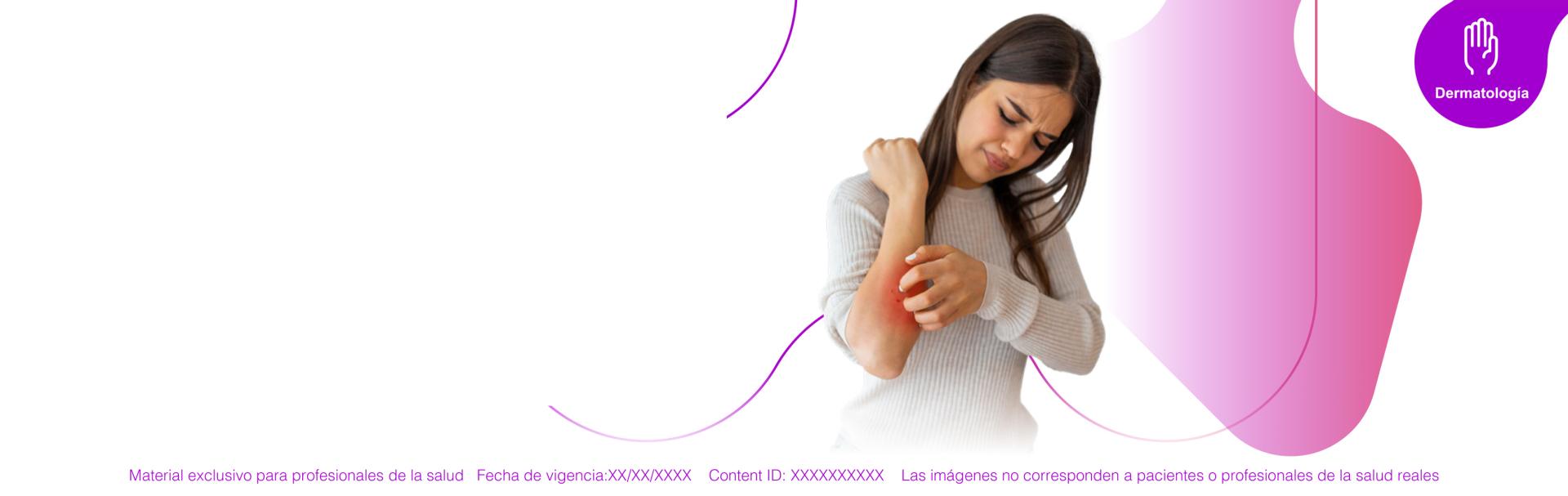 Conoce qué es la Psoriasis: Tipos, causas, tratamientos y más con MedForum